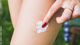 Frau behandelt Stich am Bein mit weißer Creme - Foto: iStock / Vadym Plysiuk